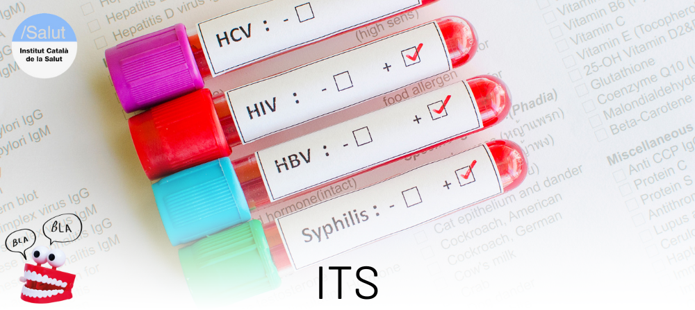 Infeccions de transmissió sexual