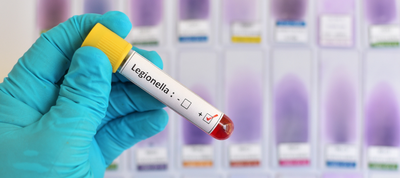 Nova legislació de legionel·la